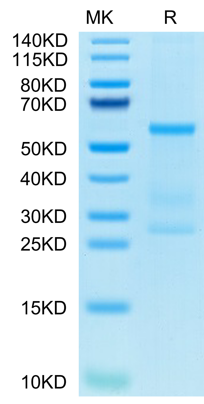 Human IL-27 on Tris-Bis PAGE under reduced condition. The purity is greater than 95%.Recombinant Human IL-27 Protein, Active