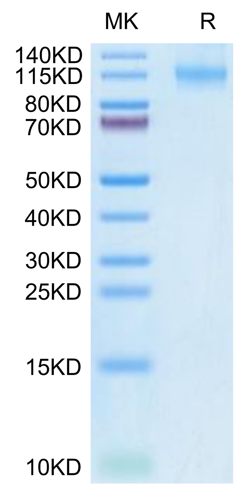 Human FLT3 on Tris-Bis PAGE under reduced condition. The purity is greater than 95%.Recombinant Human FLT3/Flk-2 Protein, Active