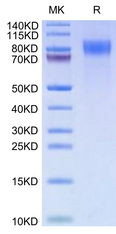 Cynomolgus CD30 on Tris-Bis PAGE under reduced condition. The purity is greater than 95%.Recombinant Cynomolgus CD30/TNFRSF8 Protein, Active