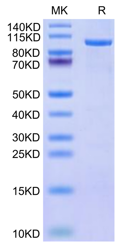 Human CDH19 on Tris-Bis PAGE under reduced condition. The purity is greater than 95%.Recombinant Human CDH19 Protein