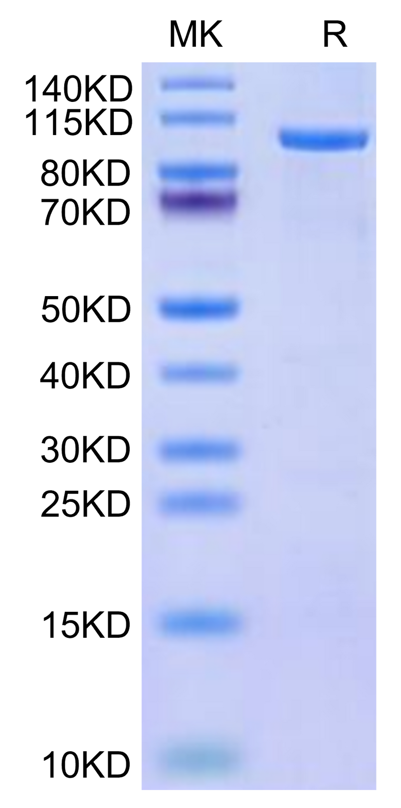 Human CDH19 on Tris-Bis PAGE under reduced condition. The purity is greater than 95%.Recombinant Human CDH19 Protein