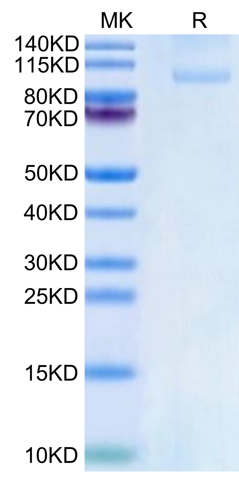 Rhesus macaque CDH17 on Tris-Bis PAGE under reduced condition. The purity is greater than 95%.Recombinant Rhesus macaque CDH17/Cadherin 17 Protein, Active