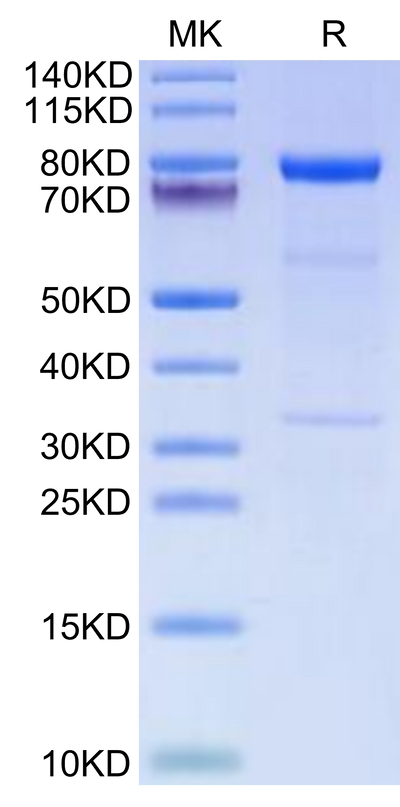 Human Complement Component C1s on Tris-Bis PAGE under reduced condition. The purity is greater than 95%.Recombinant Human Complement Component C1s Protein, Active