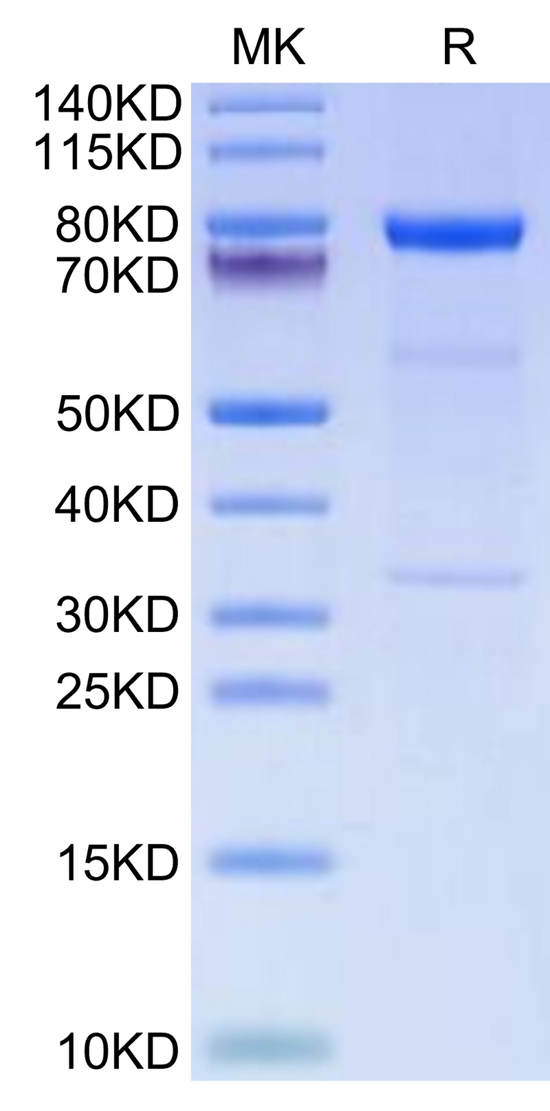 Human Complement Component C1s on Tris-Bis PAGE under reduced condition. The purity is greater than 95%.Recombinant Human Complement Component C1s Protein, Active