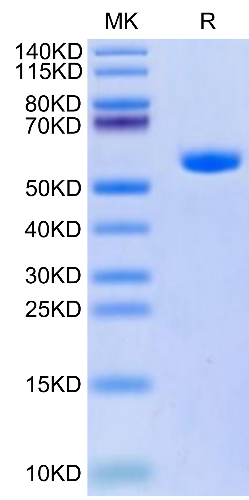 Human HLA-A*11:01&B2M&KRAS G12A (VVVGAAGVGK) Monomer on Tris-Bis PAGE under reduced condition. The purity is greater than 95%.