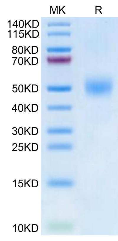 Biotinylated Human FGFR1 beta (IIIc) on Tris-Bis PAGE under reduced condition. The purity is greater than 95%.Biotinylated Human FGFR1 beta (IIIc) Protein, Active