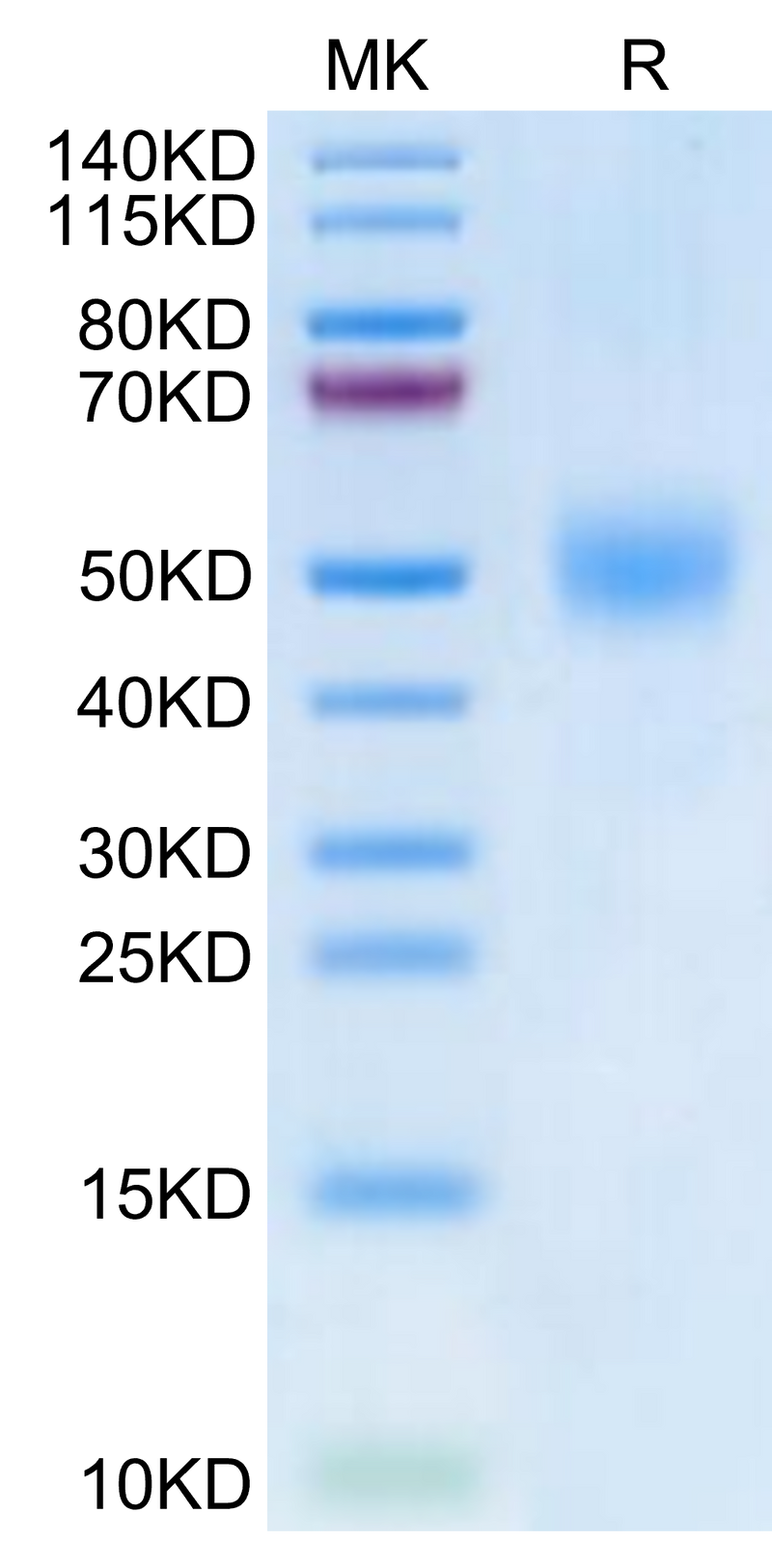 Biotinylated Human FGFR1 beta (IIIc) on Tris-Bis PAGE under reduced condition. The purity is greater than 95%.Biotinylated Human FGFR1 beta (IIIc) Protein, Active