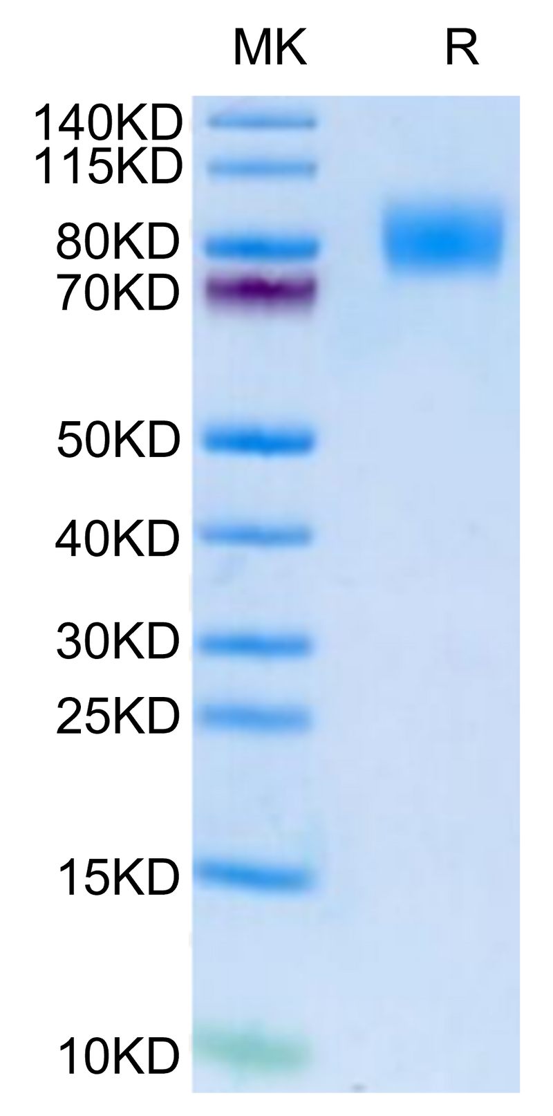 Cynomolgus IFN alpha/beta R1 on Tris-Bis PAGE under reduced condition. The purity is greater than 95%.Recombinant Cynomolgus IFN alpha/beta R1 Protein, Active