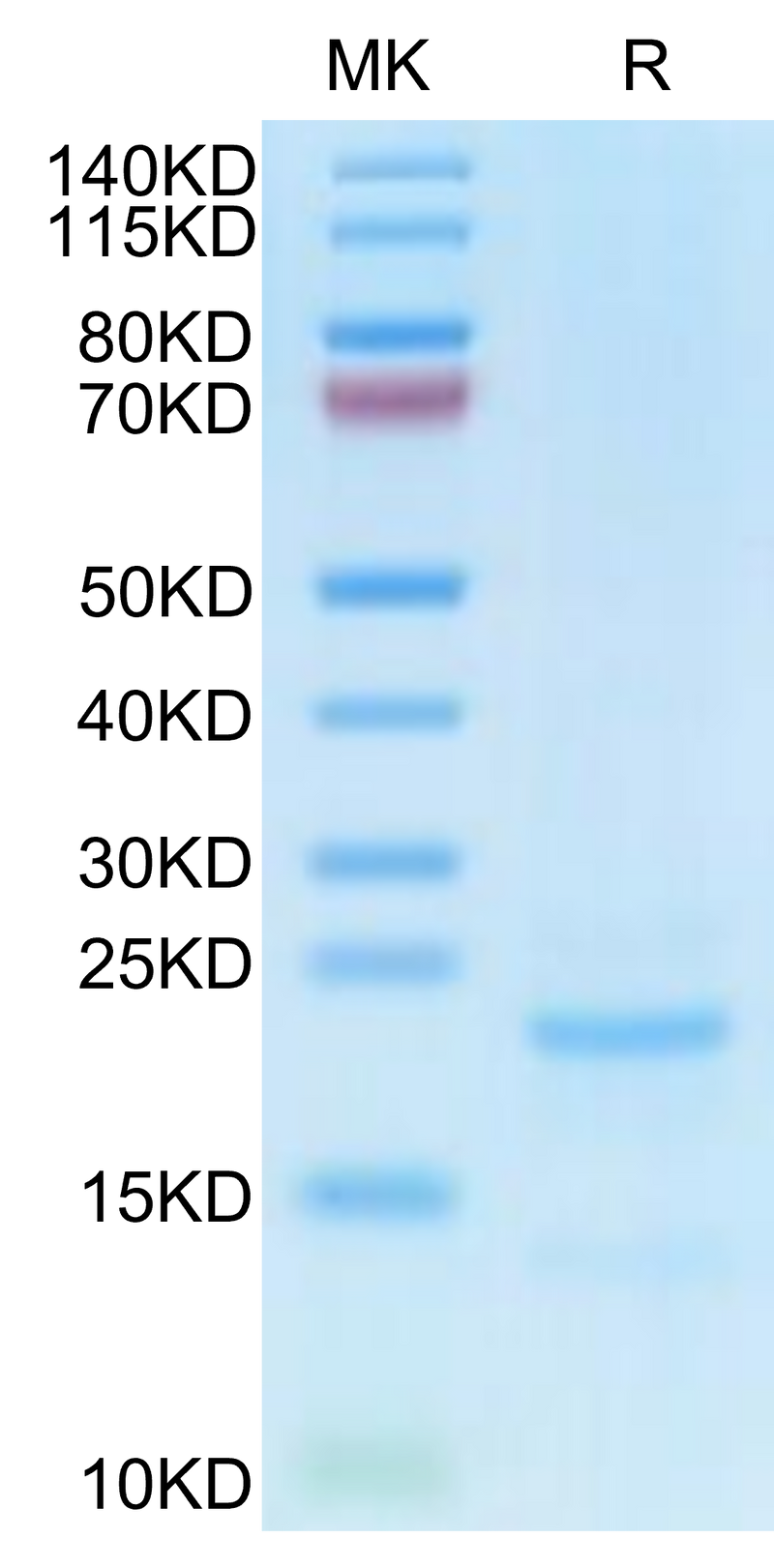 Cynomolgus NTS1 on Tris-Bis PAGE under reduced condition. The purity is greater than 90%.Recombinant Cynomolgus NTS1 Protein