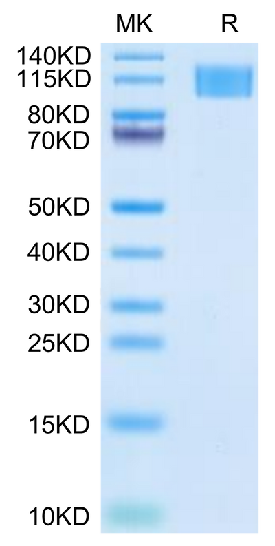 Human Aggrecan on Tris-Bis PAGE under reduced condition. The purity is greater than 95%.Recombinant Human Aggrecan Protein