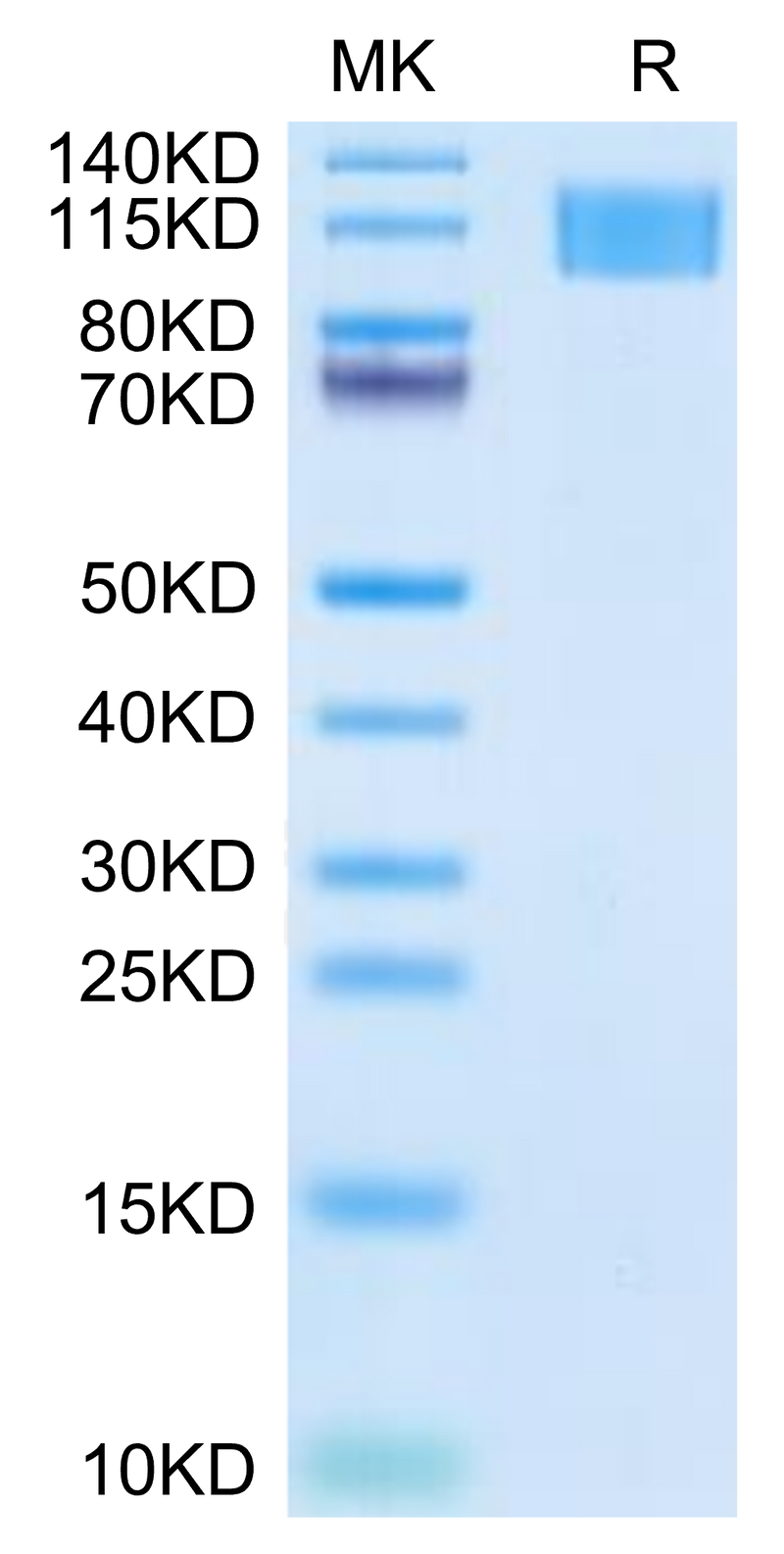 Human Aggrecan on Tris-Bis PAGE under reduced condition. The purity is greater than 95%.Recombinant Human Aggrecan Protein