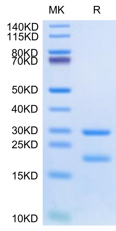 Human MASP2 on Tris-Bis PAGE under reduced condition. The purity is greater than 95%.Recombinant Human MASP2 Protein, Active