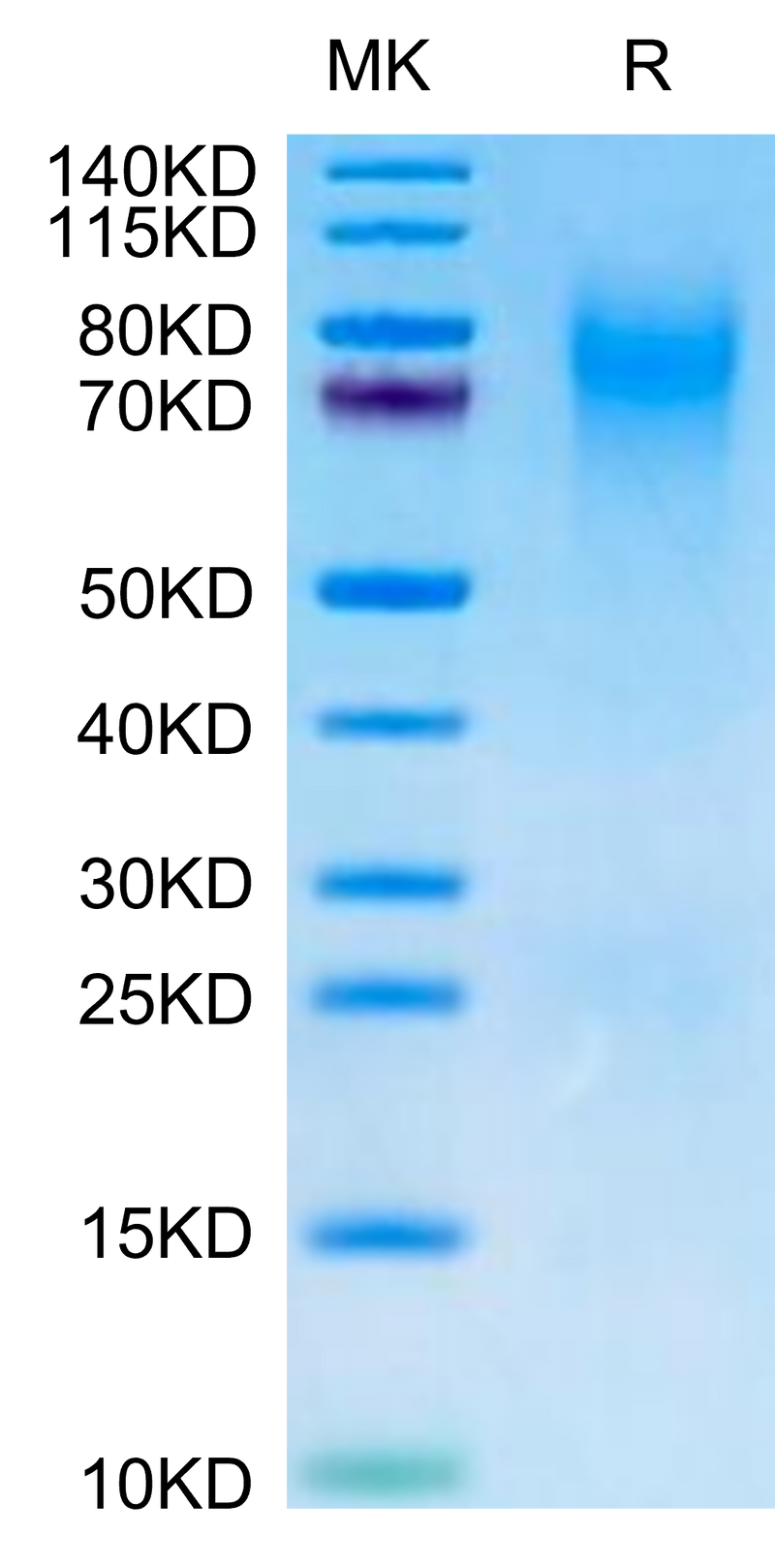 Canine CEACAM-1 on Tris-Bis PAGE under reduced condition. The purity is greater than 95%.Recombinant Canine CEACAM-1/CD66a Protein