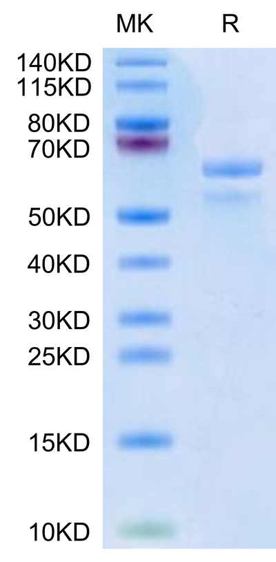 Human APOE3 on Tris-Bis PAGE under reduced condition. The purity is greater than 95%.Recombinant Human APOE3/Apolipoprotein E Protein, Active