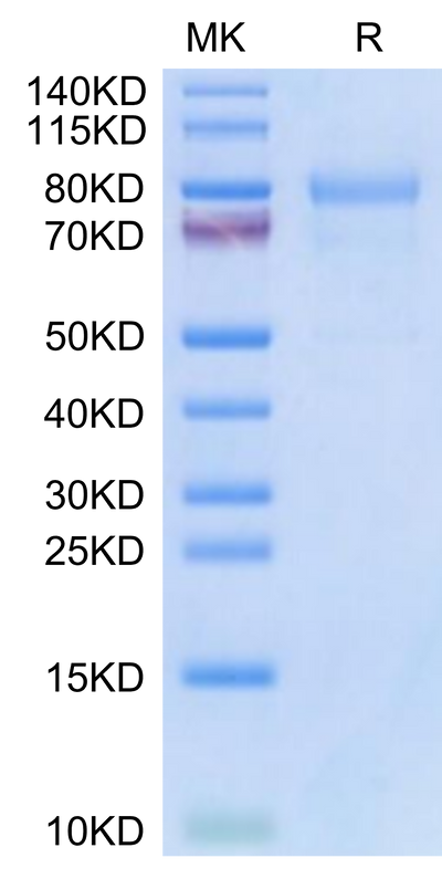 Mouse CDH6 on Tris-Bis PAGE under reduced condition. The purity is greater than 95%.Recombinant Mouse CDH6/Cadherin-6 Protein