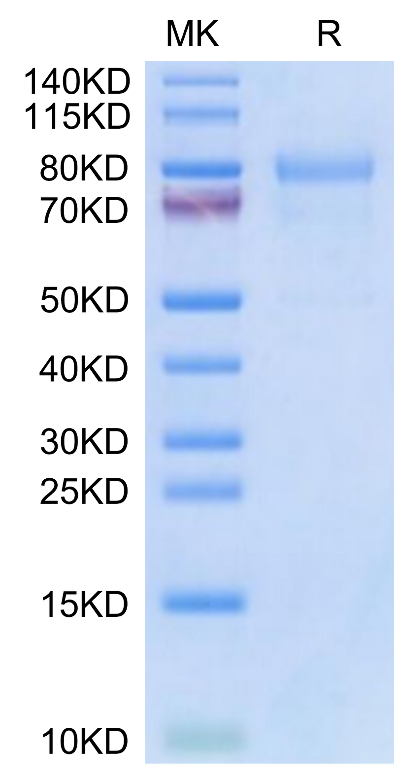 Mouse CDH6 on Tris-Bis PAGE under reduced condition. The purity is greater than 95%.