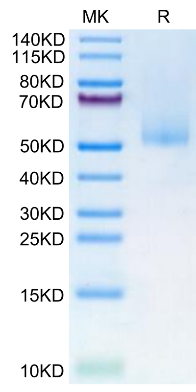 Human MICA alpha 3 on Tris-Bis PAGE under reduced condition. The purity is greater than 95%.Recombinant Human MICA alpha 3 Protein, Active