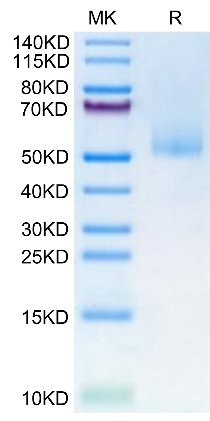 Human MICA alpha 3 on Tris-Bis PAGE under reduced condition. The purity is greater than 95%.Recombinant Human MICA alpha 3 Protein, Active