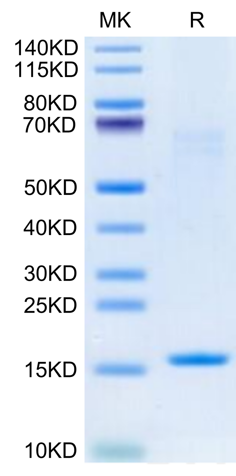 Human IL-3 on Tris-Bis PAGE under reduced condition. The purity is greater than 95%.Recombinant Human IL-3 Protein