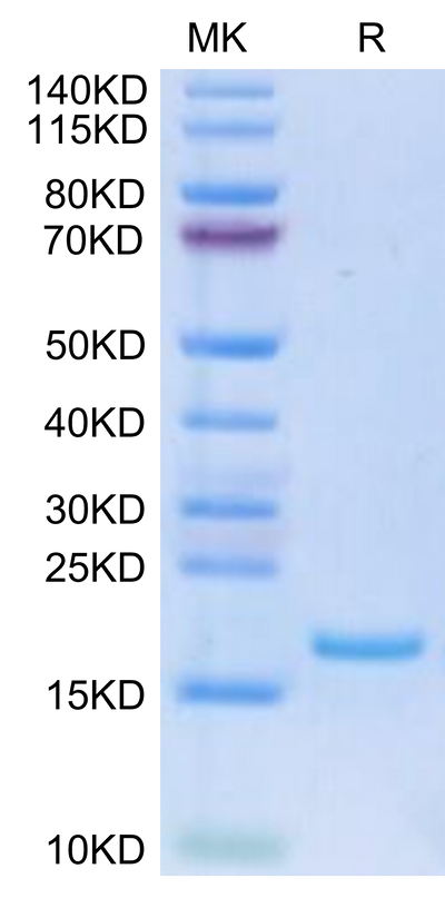 Human FLT3 Ligand on Tris-Bis PAGE under reduced condition. The purity is greater than 95%.Recombinant Human FLT3 Ligand Protein, Active