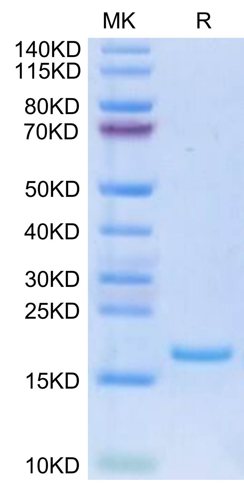 Human FLT3 Ligand on Tris-Bis PAGE under reduced condition. The purity is greater than 95%.Recombinant Human FLT3 Ligand Protein, Active