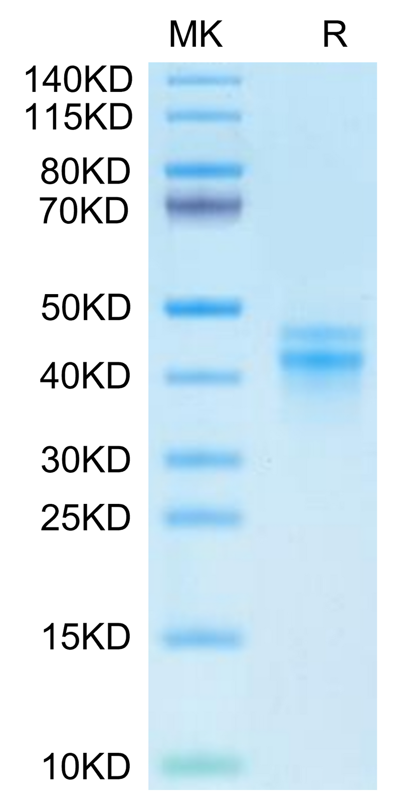 Cynomolgus IL-12 on Tris-Bis PAGE under reduced condition. The purity is greater than 95%.Recombinant Cynomolgus IL-12 Protein, Active