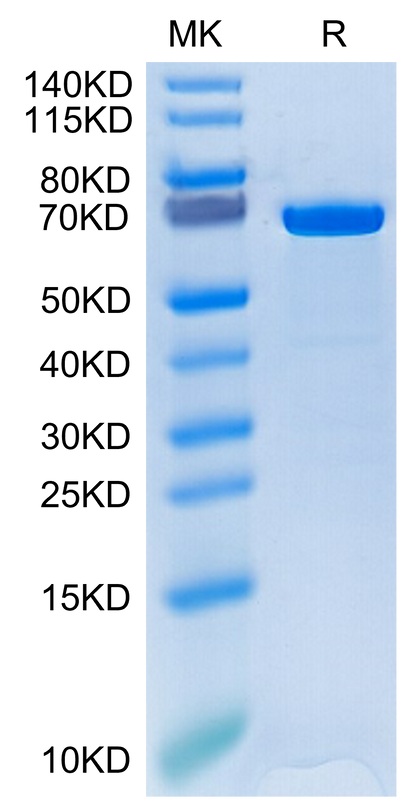 Human HSP70 on Tris-Bis PAGE under reduced condition. The purity is greater than 95%.Recombinant Human HSP70 Protein
