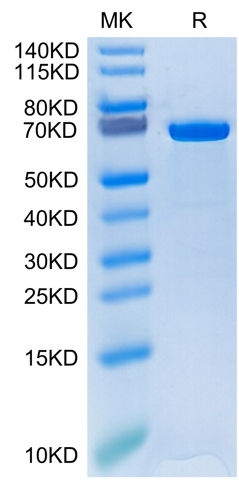 Human HSP70 on Tris-Bis PAGE under reduced condition. The purity is greater than 95%.Recombinant Human HSP70 Protein