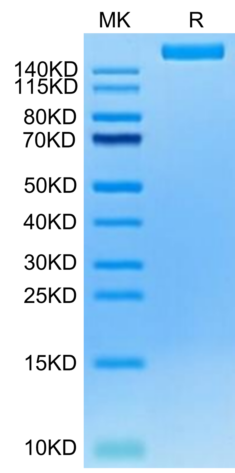 Cynomolgus LY75 on Tris-Bis PAGE under reduced condition. The purity is greater than 95%.Recombinant Cynomolgus LY75/CD205 Protein