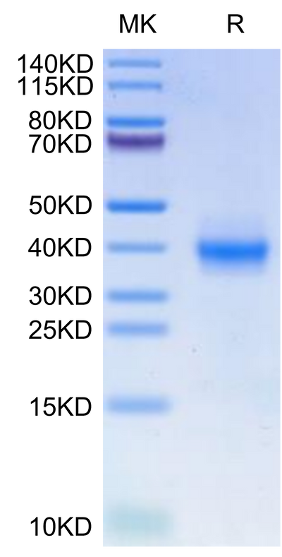 Human PD-L1 on Tris-Bis PAGE under reduced condition. The purity is greater than 95%.Recombinant Human PD-L1/B7-H1 Protein, Active