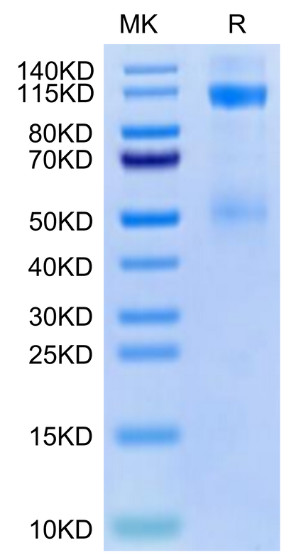 Cynomolgus IGF1R on Tris-Bis PAGE under reduced condition. The purity is greater than 95%.Recombinant Cynomolgus IGF1R/CD221 Protein, Active