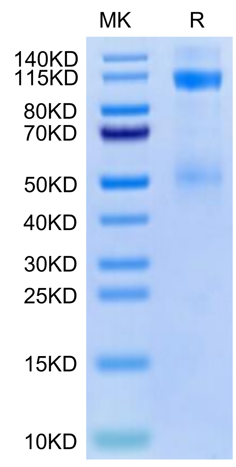 Cynomolgus IGF1R on Tris-Bis PAGE under reduced condition. The purity is greater than 95%.Recombinant Cynomolgus IGF1R/CD221 Protein, Active