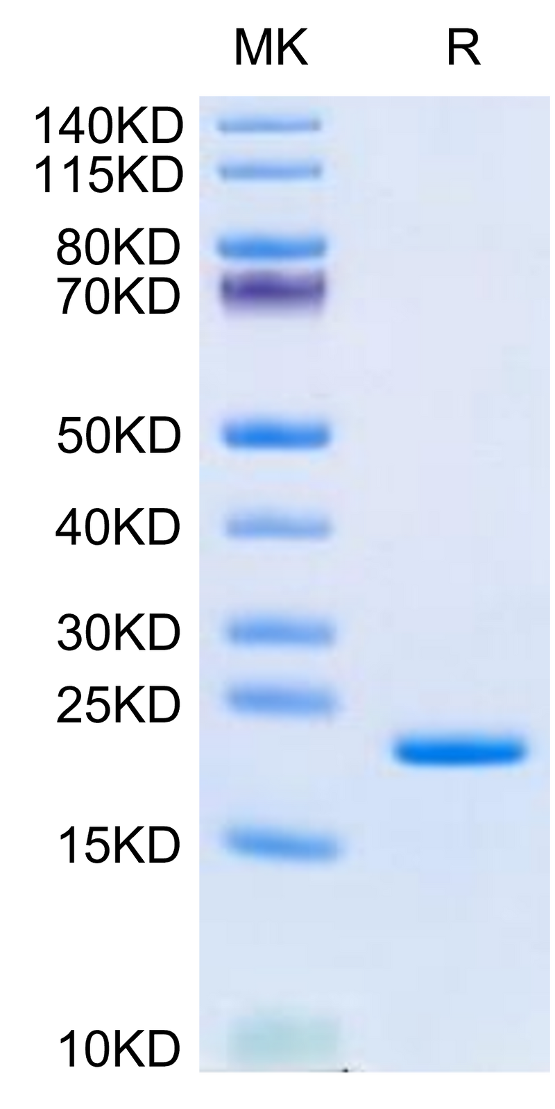 Human LIF on Tris-Bis PAGE under reduced condition. The purity is greater than 95%.Recombinant Human LIF Protein, Active