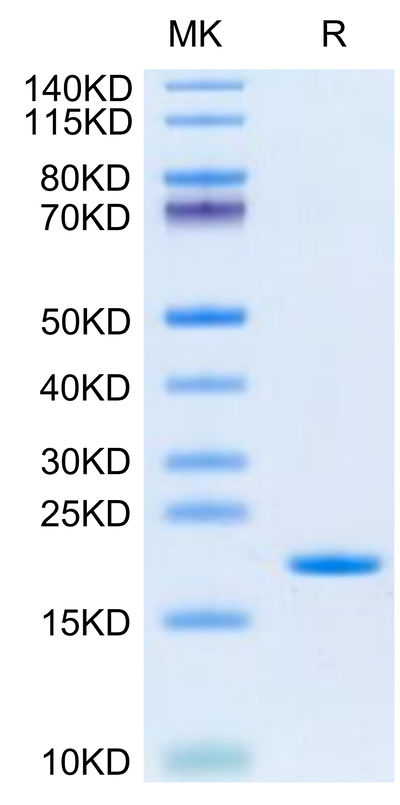 Human SCF on Tris-Bis PAGE under reduced condition. The purity is greater than 95%.Recombinant Human SCF Protein, Active