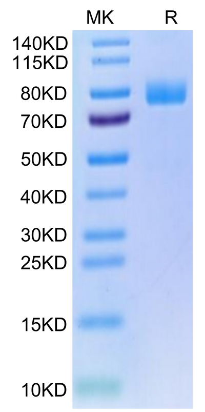 Human MICA on Tris-Bis PAGE under reduced condition. The purity is greater than 95%.Recombinant Human MICA Protein, Active