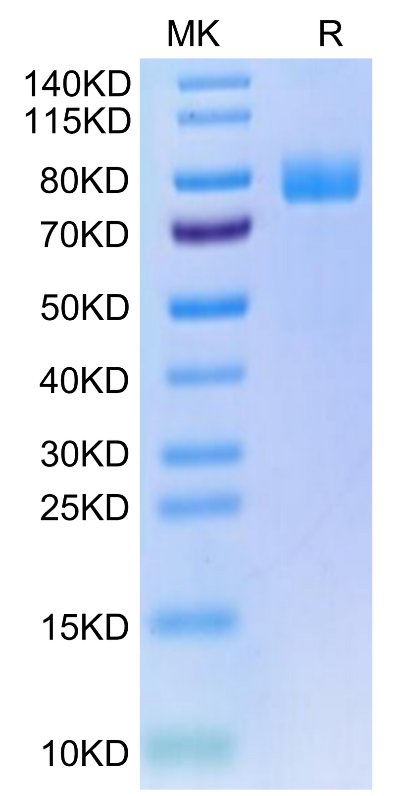Human MICA on Tris-Bis PAGE under reduced condition. The purity is greater than 95%.Recombinant Human MICA Protein, Active