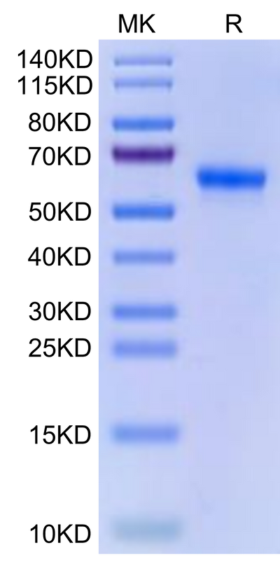 Human ULBP-2 on Tris-Bis PAGE under reduced condition. The purity is greater than 95%.Recombinant Human ULBP-2 Protein, Active