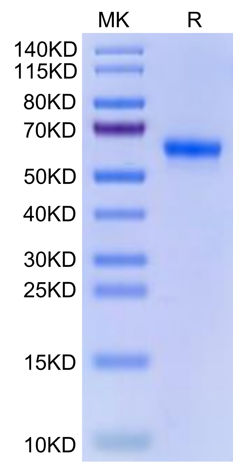 Human ULBP-2 on Tris-Bis PAGE under reduced condition. The purity is greater than 95%.Recombinant Human ULBP-2 Protein, Active
