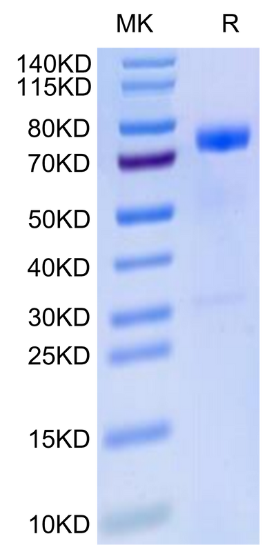 Human MICB on Tris-Bis PAGE under reduced condition. The purity is greater than 95%.Recombinant Human MICB Protein, Active