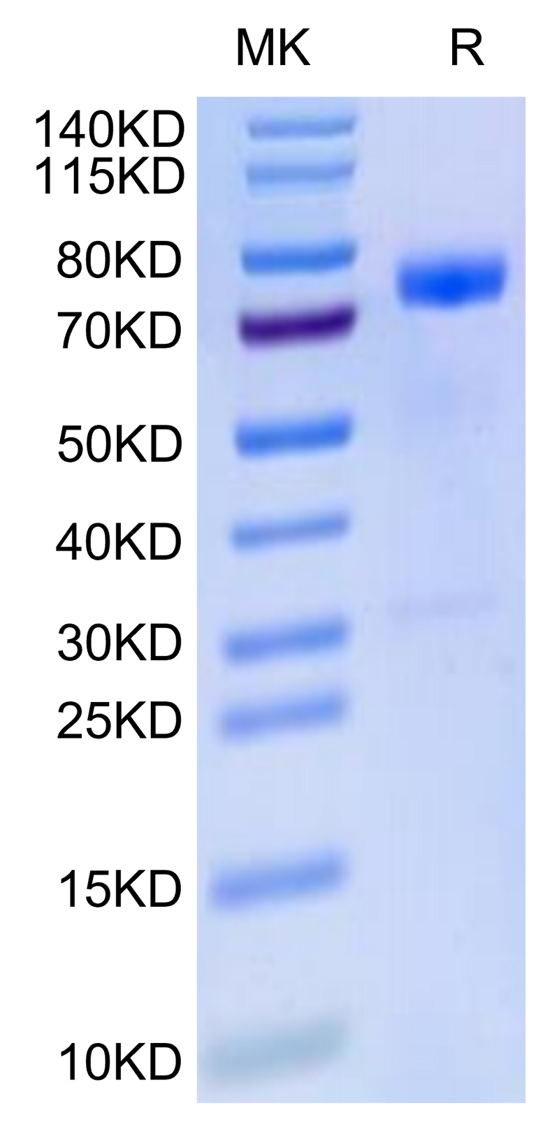 Human MICB on Tris-Bis PAGE under reduced condition. The purity is greater than 95%.Recombinant Human MICB Protein, Active