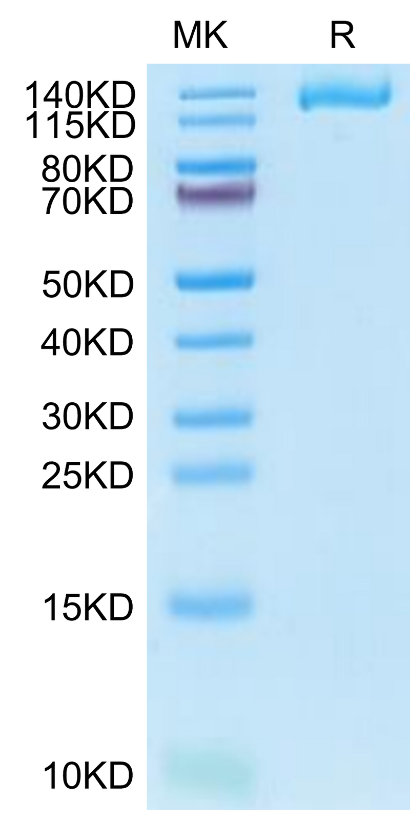 Human IGF2R Domain 1-7 on Tris-Bis PAGE under reduced condition. The purity is greater than 95%.Recombinant Human IGF2R Domain 1-7 Protein