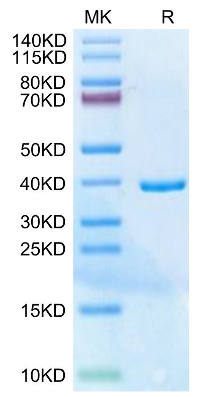 Human HLA-G Free heavy chain on Tris-Bis PAGE under reduced condition. The purity is greater than 95%.Recombinant Human HLA-G Free Heavy Chain Protein, Active