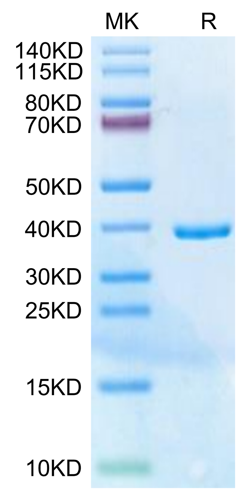 Human HLA-G Free heavy chain on Tris-Bis PAGE under reduced condition. The purity is greater than 95%.Recombinant Human HLA-G Free Heavy Chain Protein, Active