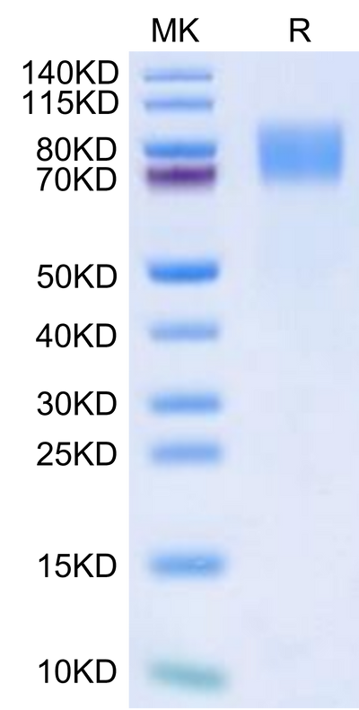 Biotinylated Mouse GUCY2C on Tris-Bis PAGE under reduced condition. The purity is greater than 95%.Biotinylated Mouse GUCY2C/Guanylyl cyclase C Protein