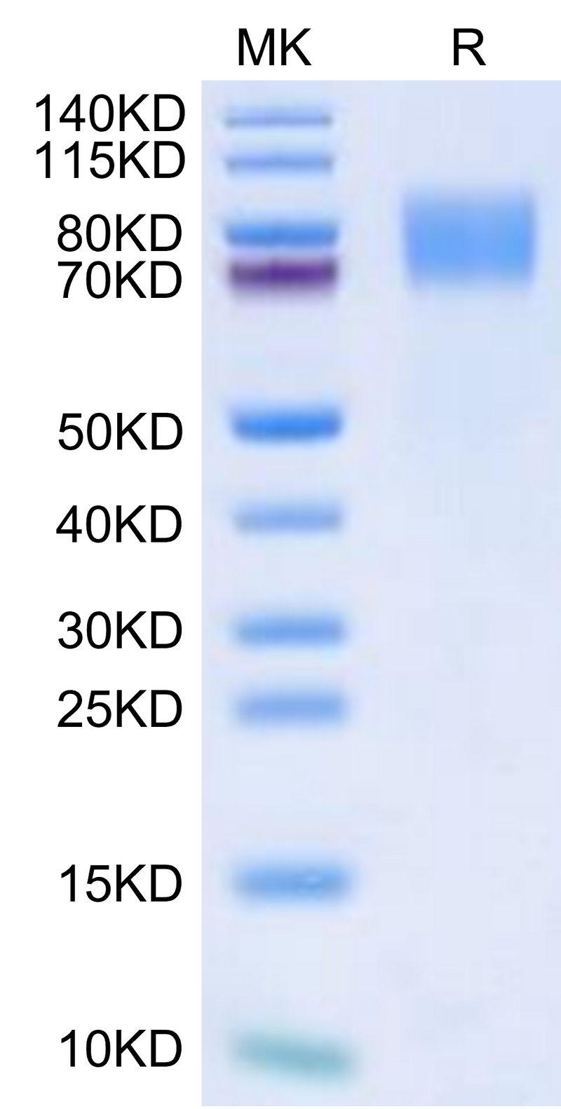 Biotinylated Mouse GUCY2C on Tris-Bis PAGE under reduced condition. The purity is greater than 95%.Biotinylated Mouse GUCY2C/Guanylyl cyclase C Protein
