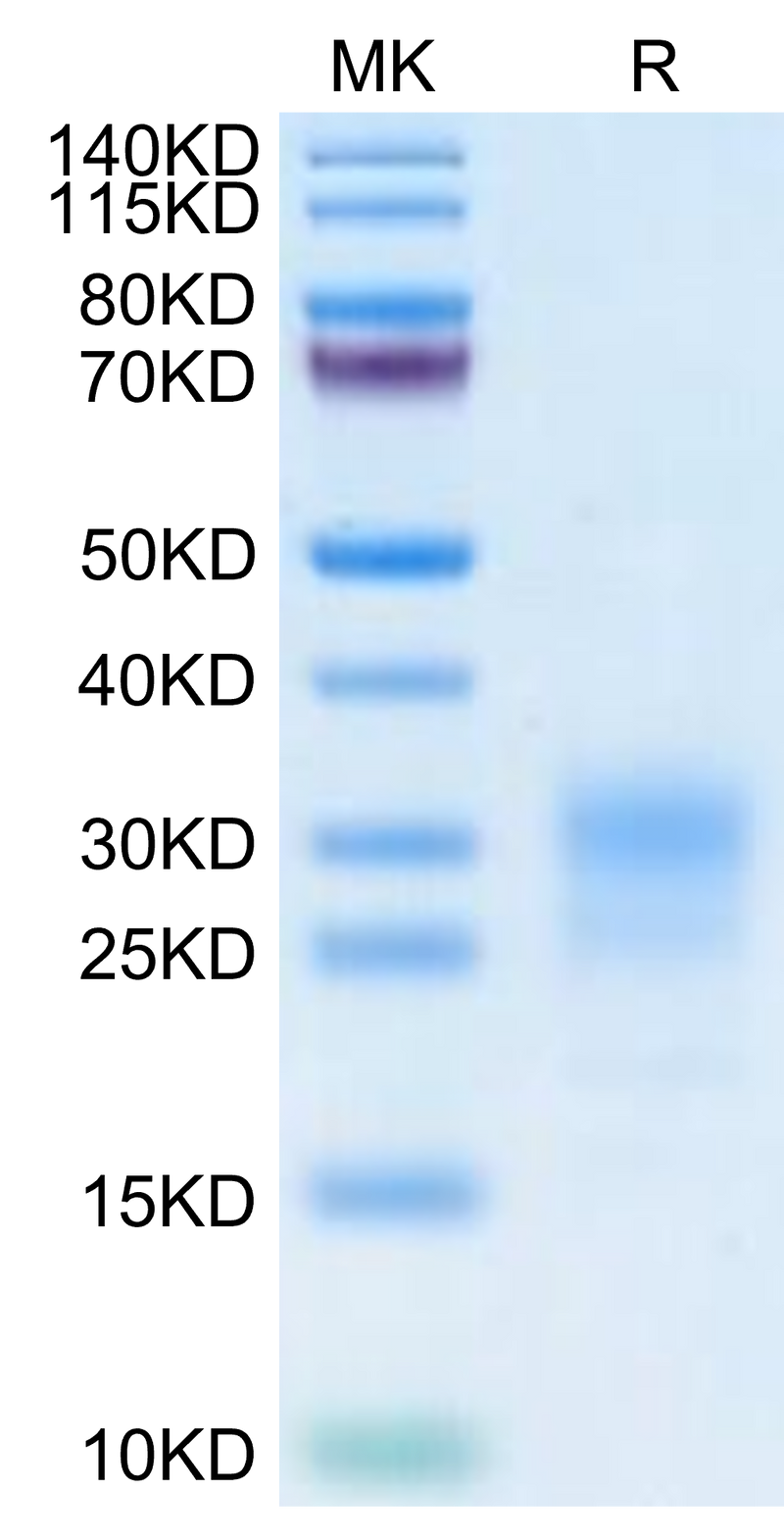 Cynomolgus IFN gamma on Tris-Bis PAGE under reduced condition. The purity is greater than 95%.Recombinant Cynomolgus IFN gamma/IFNG Protein, Active