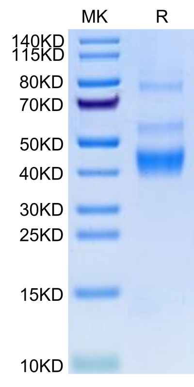 Human LAP (TGF beta 1) on Tris-Bis PAGE under reduced condition. The purity is greater than 95%.Recombinant Human LAP (TGF beta 1) Protein, Active