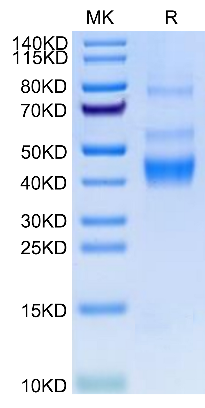 Human LAP (TGF beta 1) on Tris-Bis PAGE under reduced condition. The purity is greater than 95%.Recombinant Human LAP (TGF beta 1) Protein, Active