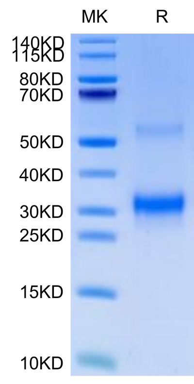 Cynomolgus BDCA-2 on Tris-Bis PAGE under reduced condition. The purity is greater than 95%.Recombinant Cynomolgus BDCA-2 Protein, Active