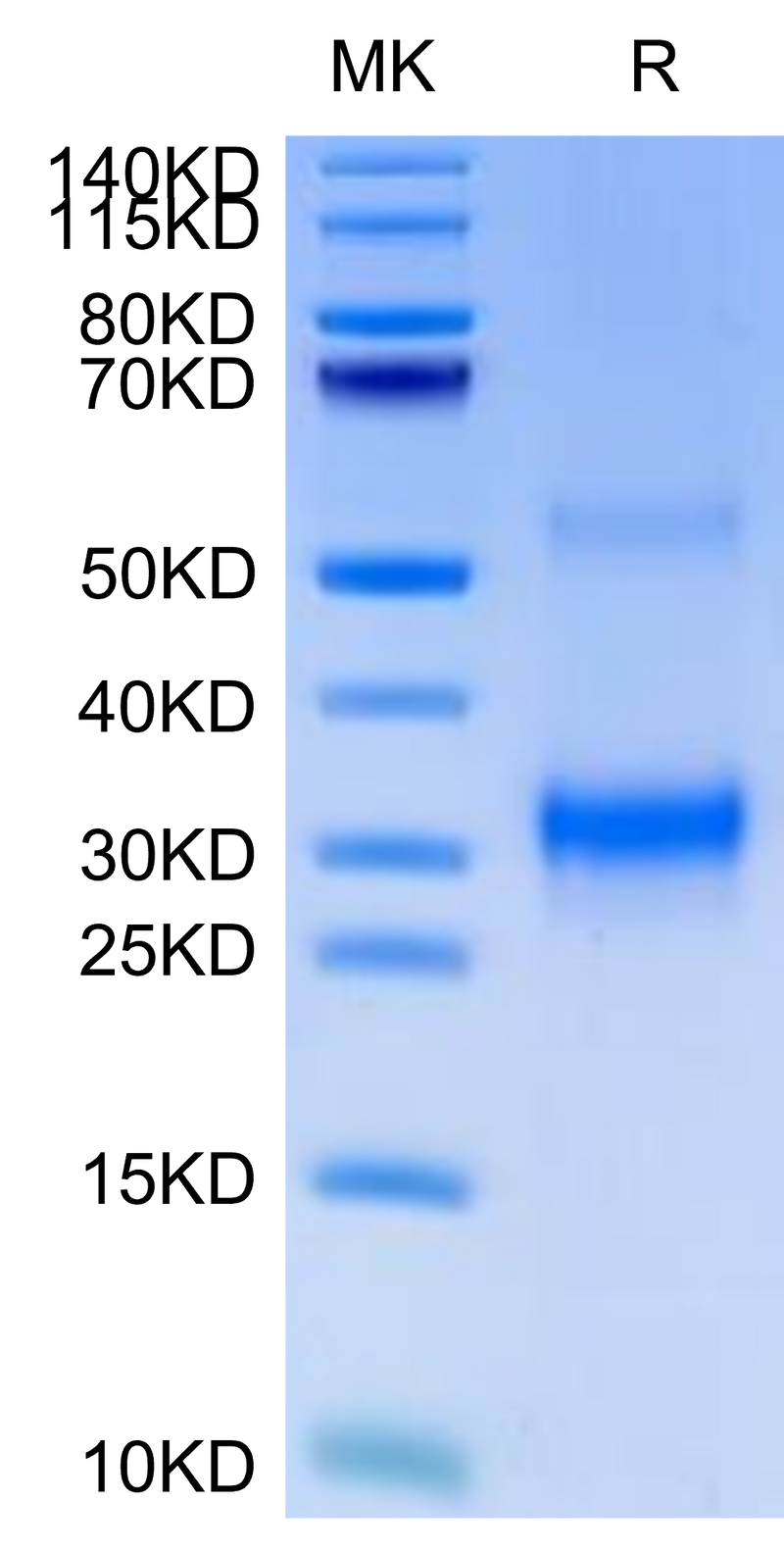 Cynomolgus BDCA-2 on Tris-Bis PAGE under reduced condition. The purity is greater than 95%.Recombinant Cynomolgus BDCA-2 Protein, Active